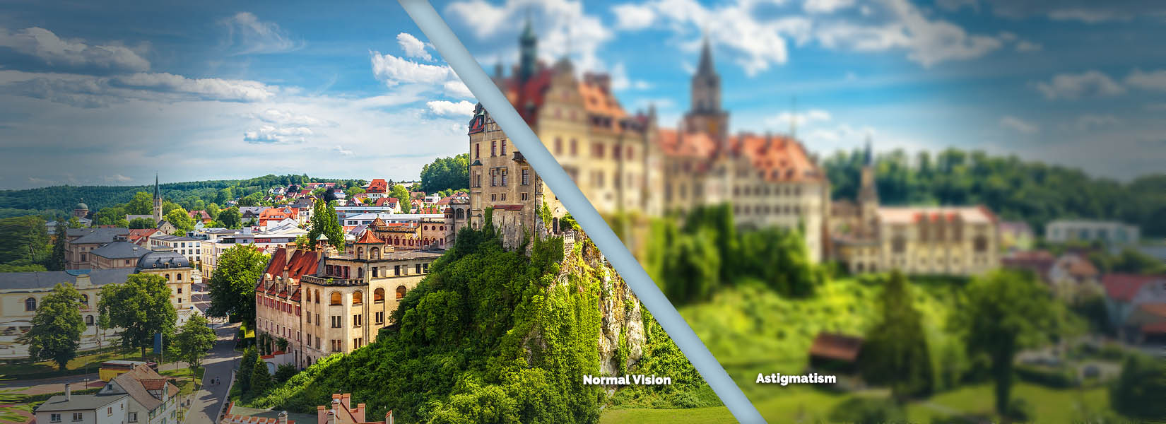 Astigmatism Treatment in Edwardsville