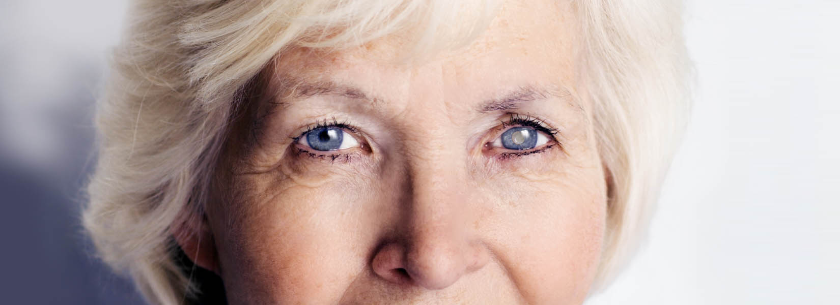 Cataract Surgery in Edwardsville